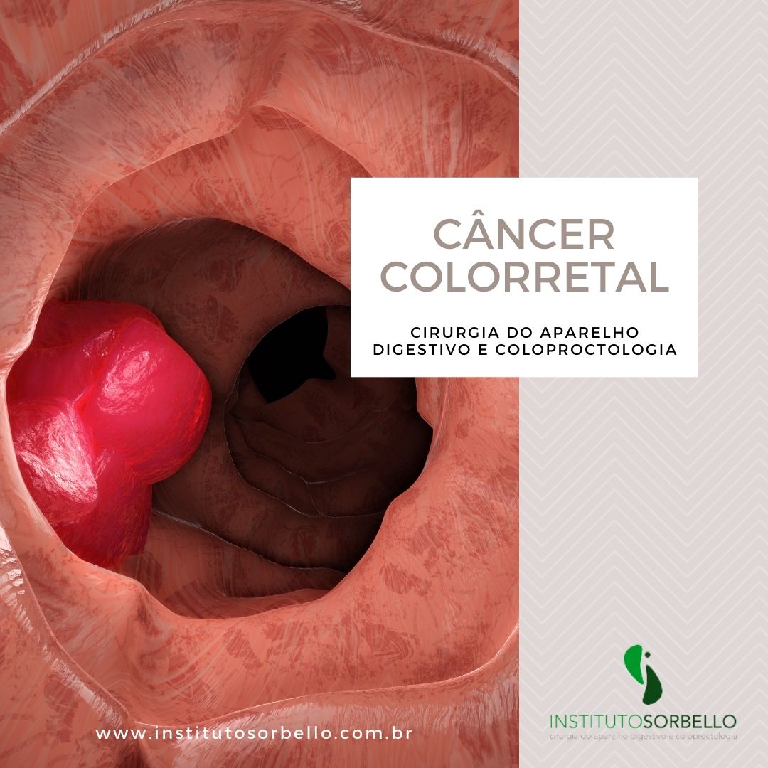 câncer colorretal