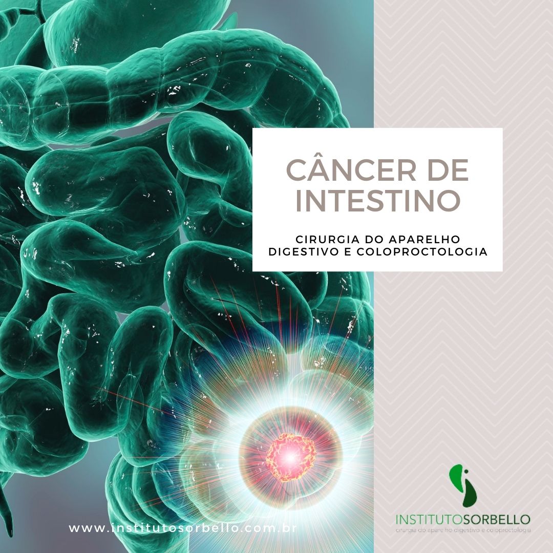 câncer de intestino