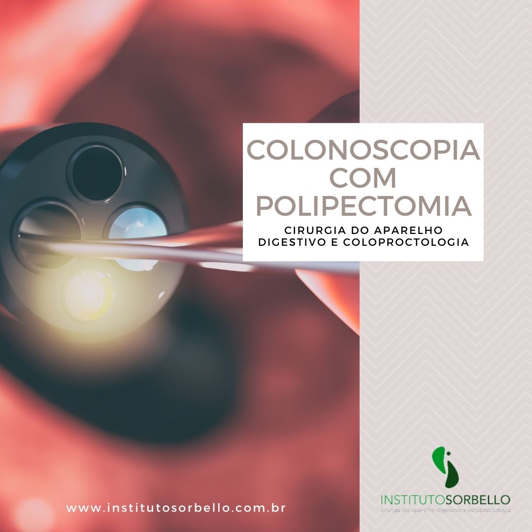 Colonoscopia com Polipectomia