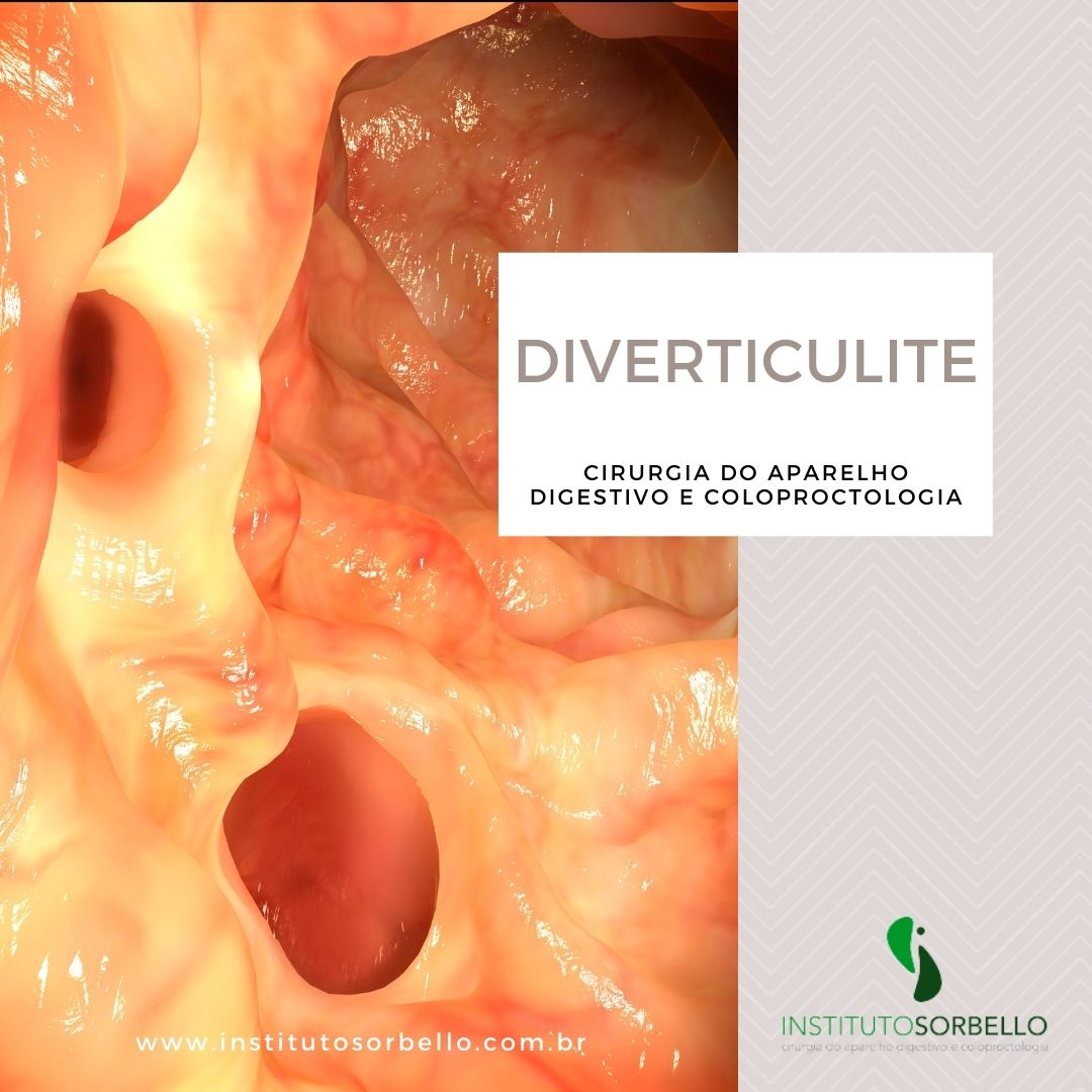 Diverticulite 9206